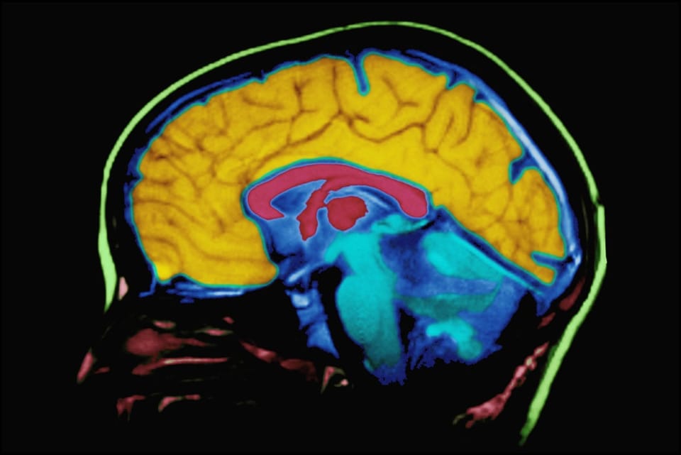 科技对大脑影响复杂，神经科学家呼吁精细化研究